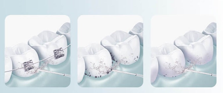 Draagbaar Tandheelkundig Waterflosser