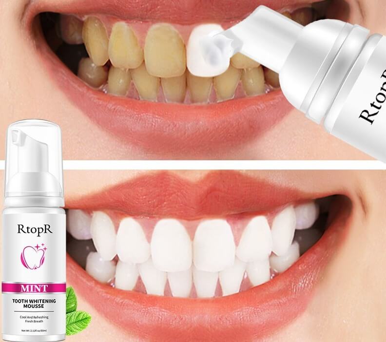 Whitening Vlekkenverwijderingsmousse
