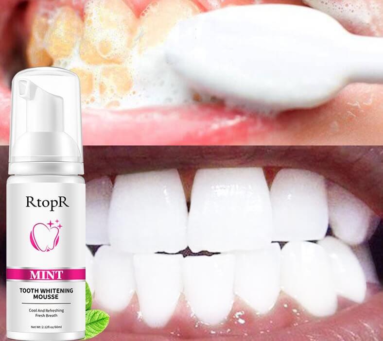 Whitening Vlekkenverwijderingsmousse