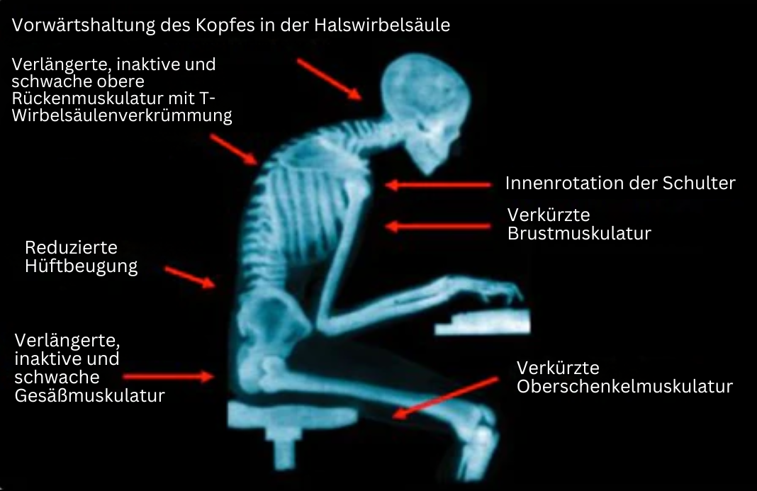 Houdingsband voor Dames en Heren met EMS Technologie 3