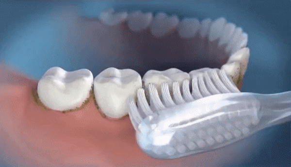 Waterflosser Met 3 Drukinstellingen En 360° Draaibaar Mondstuk 5