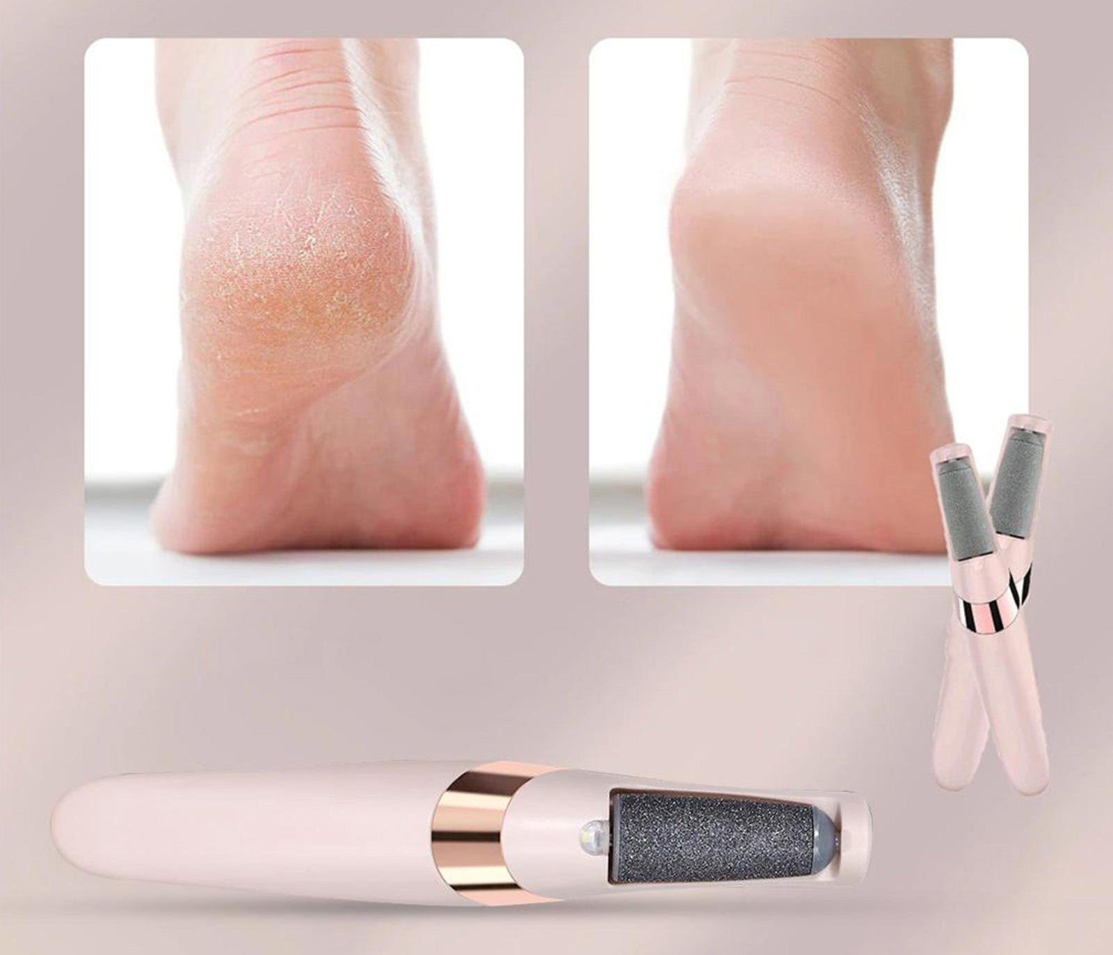 Elektrische Voetvijl