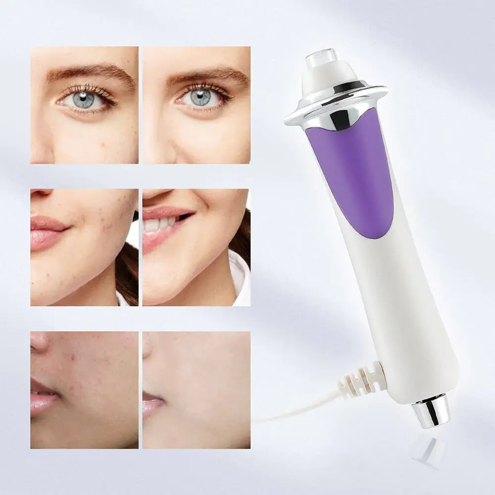 Mesotherapie Beauty Pen