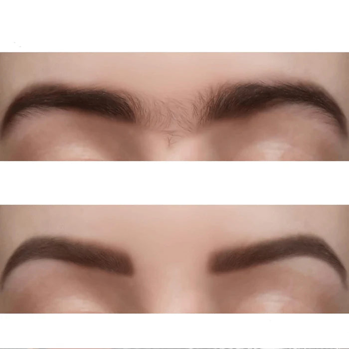 Perzikpluis verwijderaar