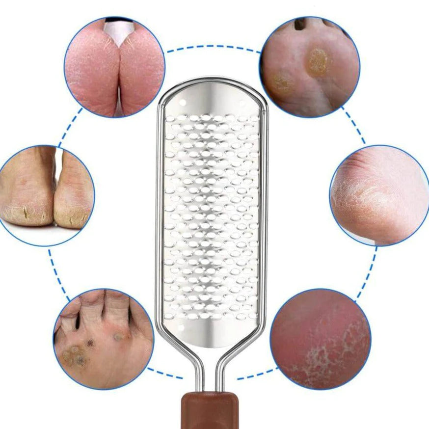 Professionele Voetvijl Eelt Verwijderaar