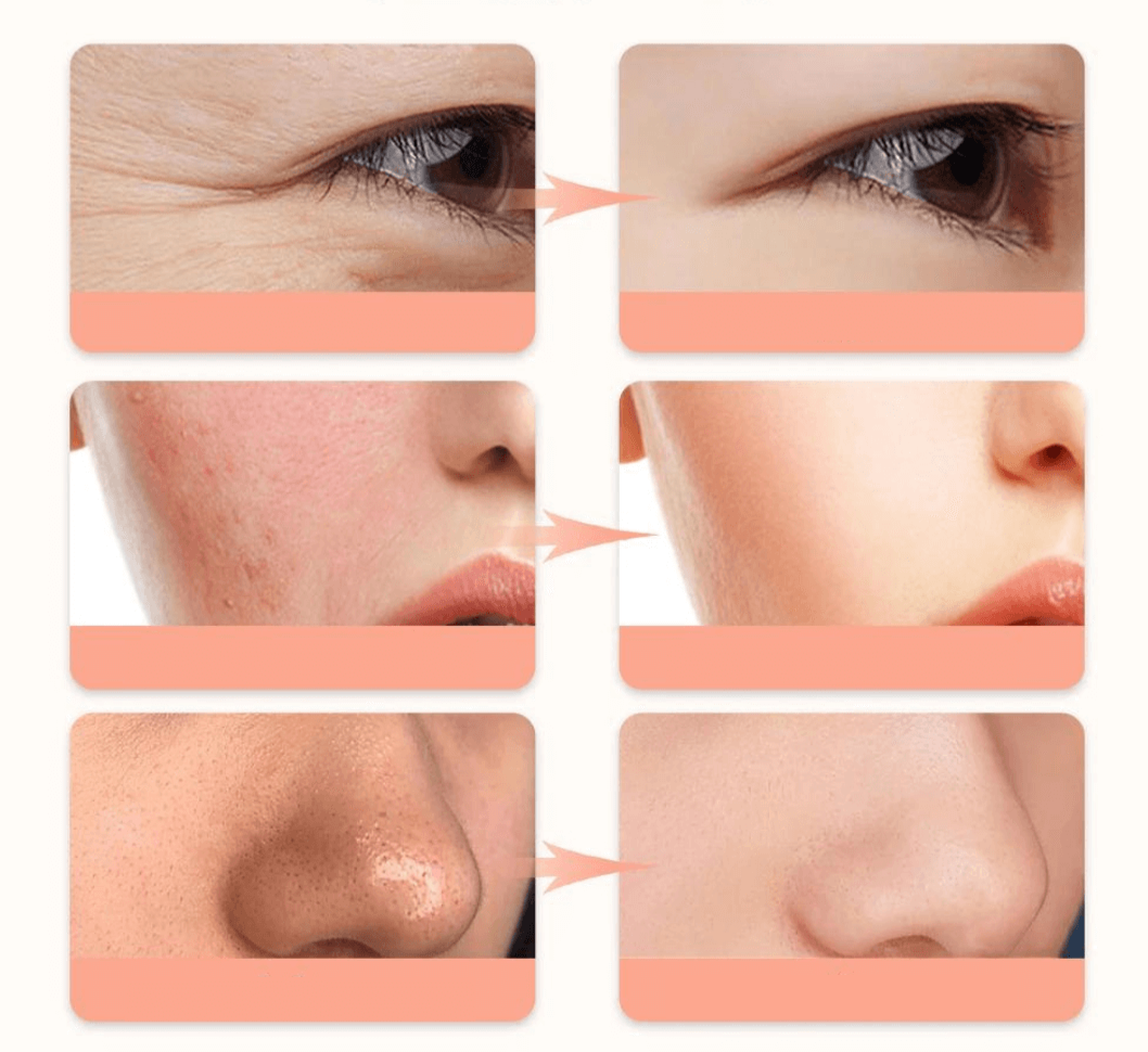 Huidverjonging LED Beauty Mask