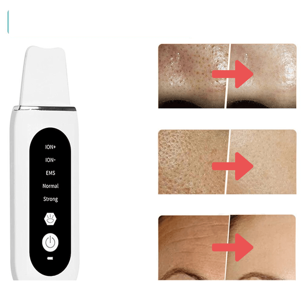 Ultrasonische Dieptereinigende Huidscrubber