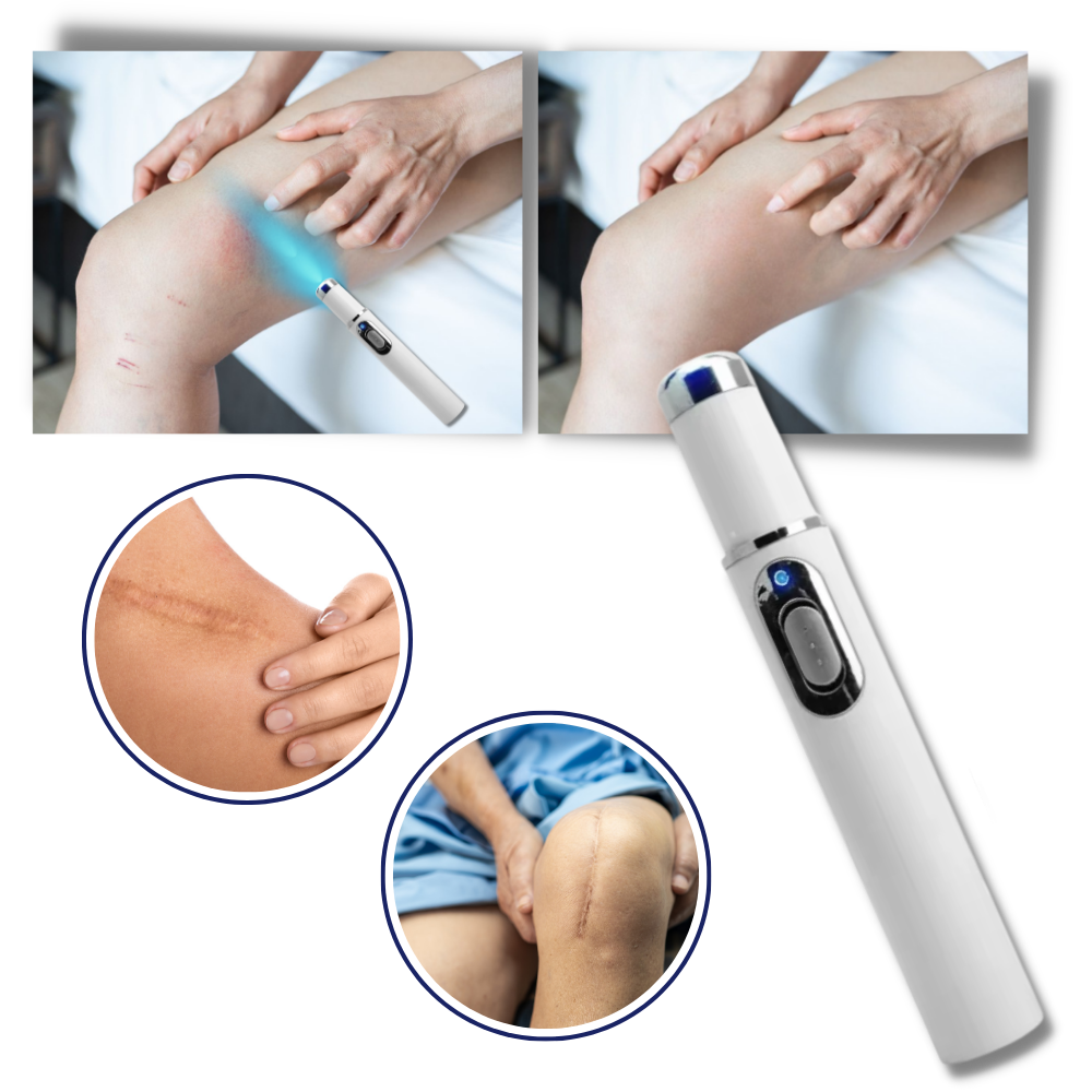 Draagbare Lasertherapie voor een Stralende Teint 3