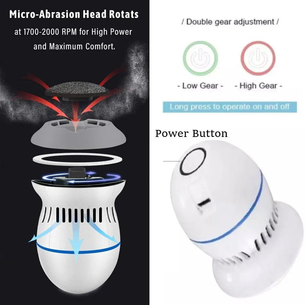 Elektrische Voetslijpmachine voor Thuisgebruik 1