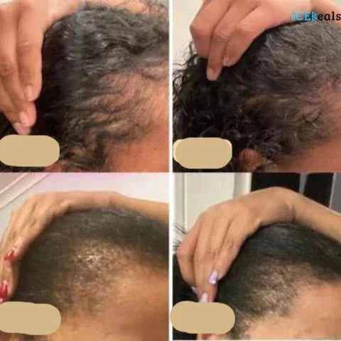 Haarolie Voor Groei En Versterking - Natuurlijke Olie Voor Haargroei 1