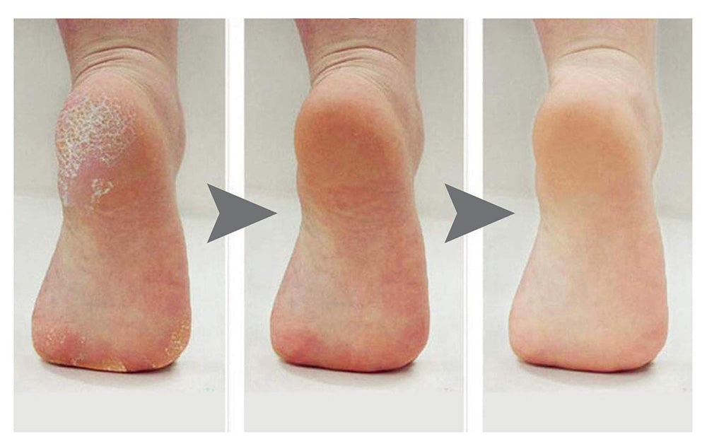 Elektrische Voetvijl