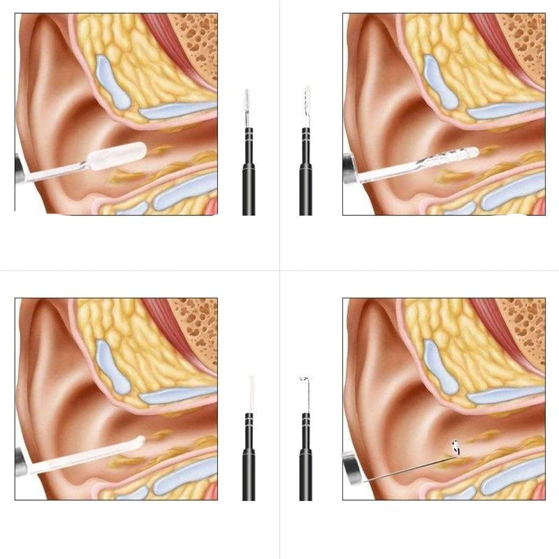 Live Ear Medicinale oor endoscoop.
