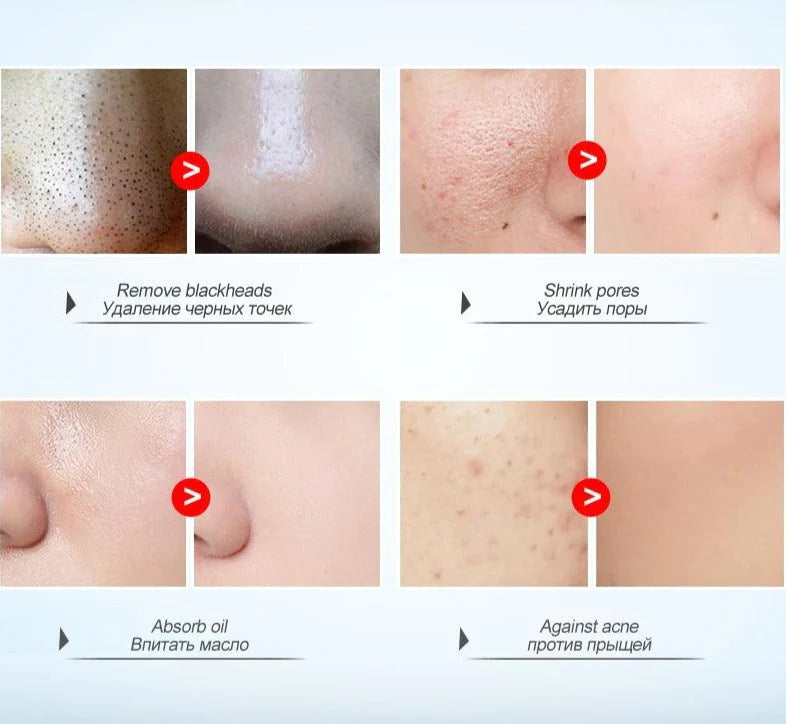 Roze Klei Masker