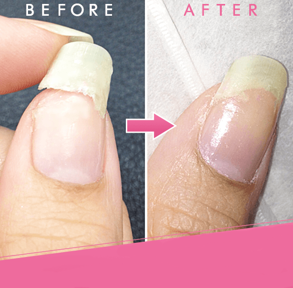 Nagel Gel