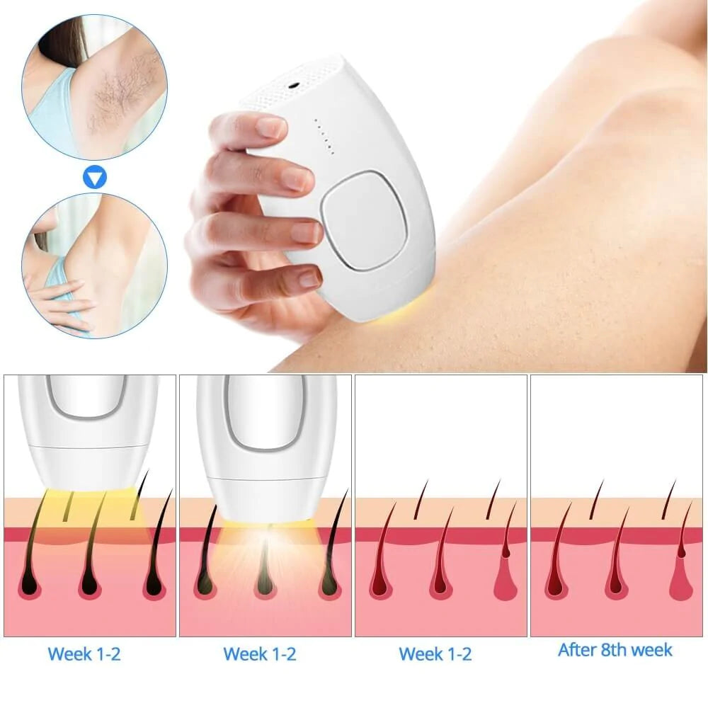 IPL Laser Ontharingsapparaat